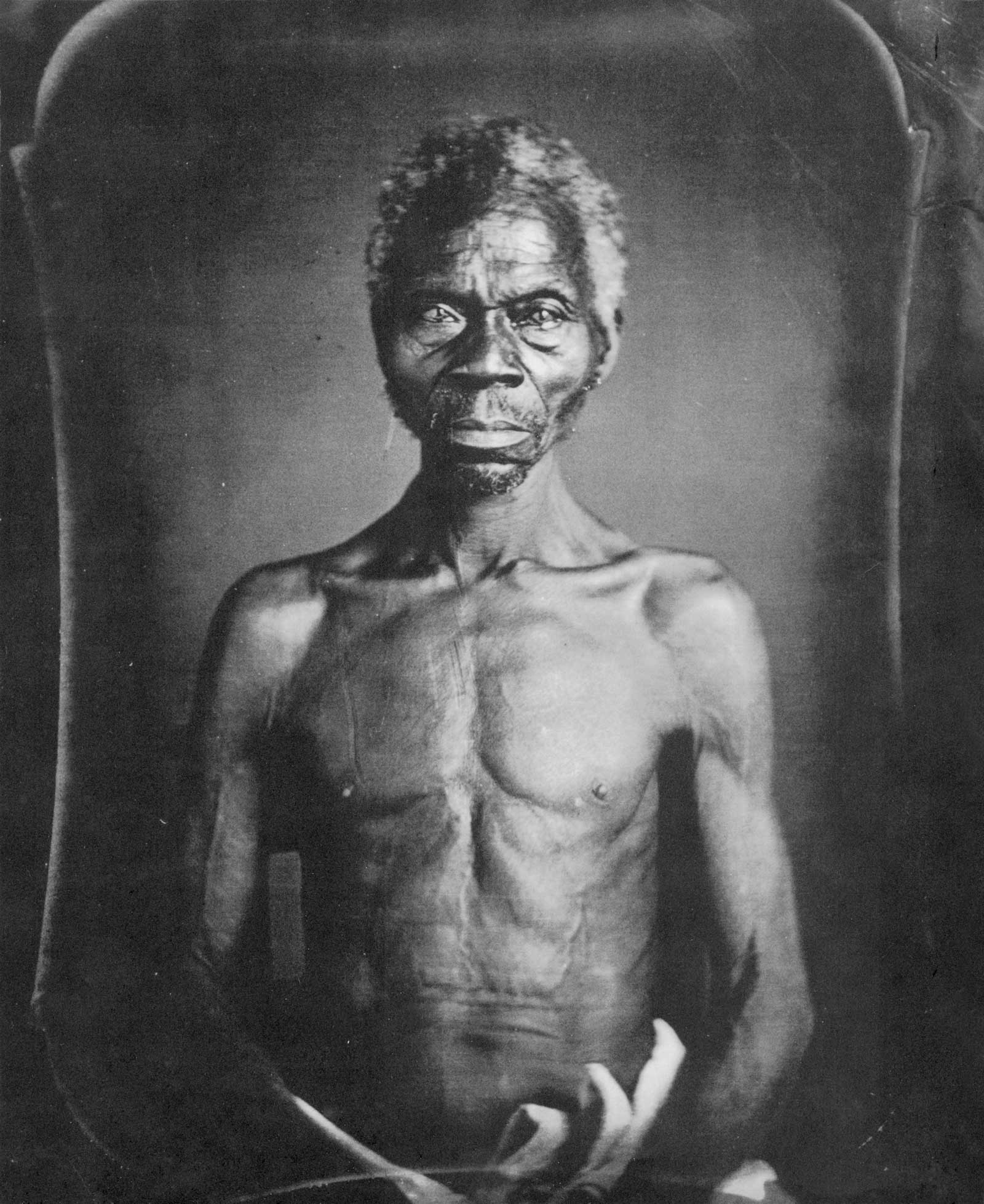 Renty an African slave, subject of Louis Agassiz