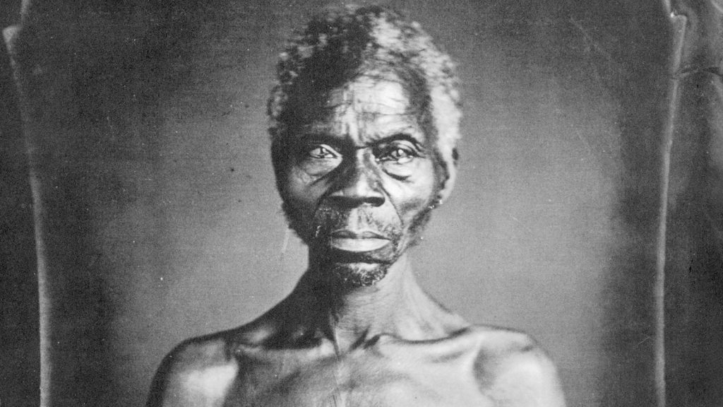 Renty an African slave, subject of Louis Agassiz